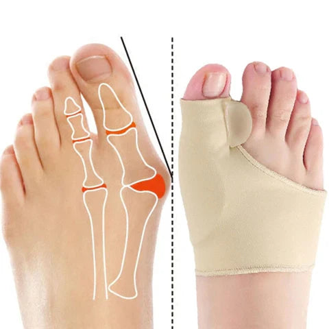OrthoLine – Adjustable Toe Separator